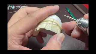 Mastering Dental Arch Customization: Tips for Natural Finish and Precision