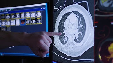 How photon-counting CT is improving access to advanced medical imaging