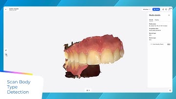 DS Core General Features - Intra Oral Scanning with Automatic Scan Body Detection