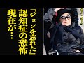 オノ・ヨーコの 「レビー小体型認知症」に思わず絶句...最愛のジョンレノンを思い出せないほど進行した病魔、ビートルズを終わらせた東洋の魔女の現在に驚きを隠せない【芸能】