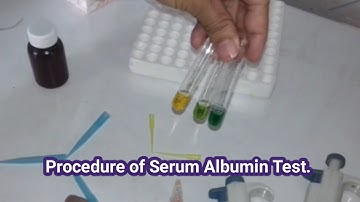 How to do Blood test Albumin?