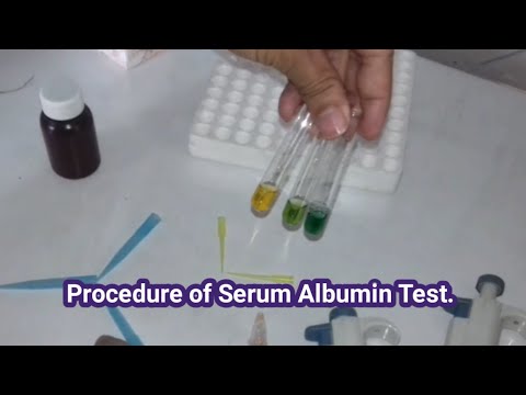 How to do Blood test Albumin?