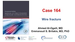 Case 164: Manual of PCI - Wire fracture