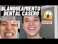 BLANQUEAMIENTO DENTAL CASERO USANDO POLANIGHT 16% CON PERÓXIDO DE CARBAMIDA // PASO A PASO!!