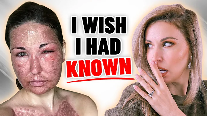 Fractional CO2 Laser: 20 Questions You NEED to ASK!