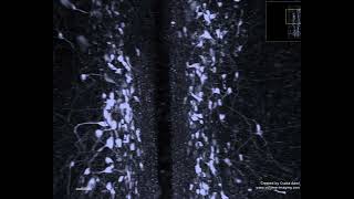 3D volume imaging - CATECHOLAMINERGIC NUCELI MOVIE 2