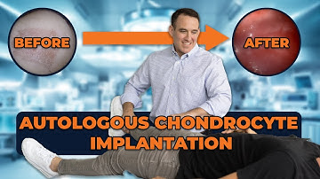 Autologous Chondrocyte Implantation