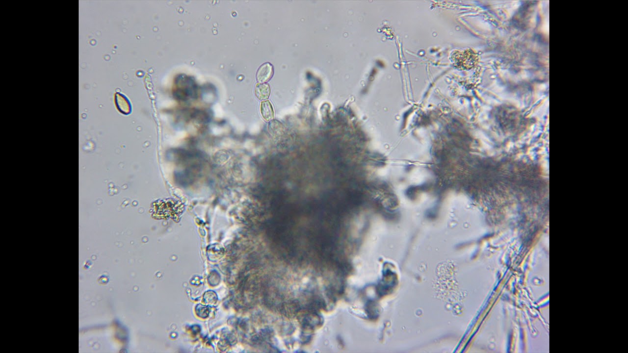 Fungal spores with actino bacteria 