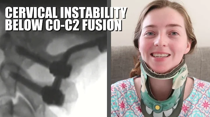 Caring Medical Evaluation // Cervical Instability, POTS, Intracranial Hypertension, Vagus Nerve