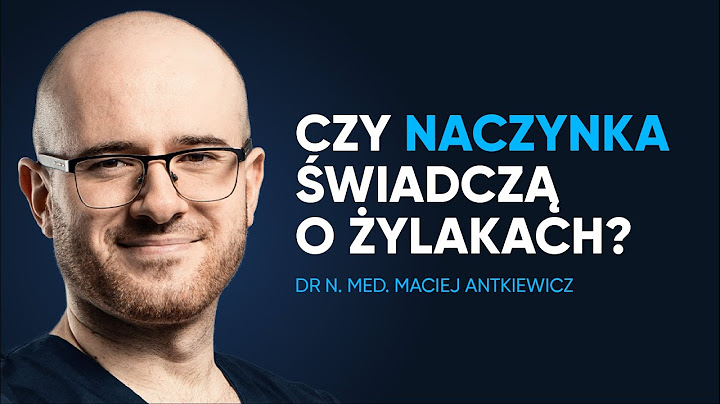 Czy osoby z naczynkami są bardziej PODATNE na żylaki?