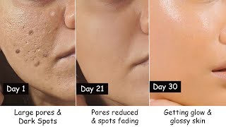 i transformed my Skin in 30 Days | Close Large Open Pores, Dark Spots, Hyperpigmentation, Wrinkles