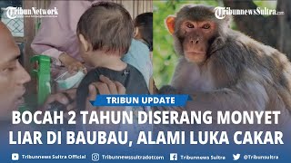 Download Lagu Viral Bocah 2 Tahun Diserang Monyet Liar di Baubau Sulawesi Tenggara, Alami Luka Cakaran MP3 Download Lagu Viral Bocah 2 Tahun Diserang Monyet Liar di Baubau Sulawesi Tenggara, Alami Luka Cakaran MP3
