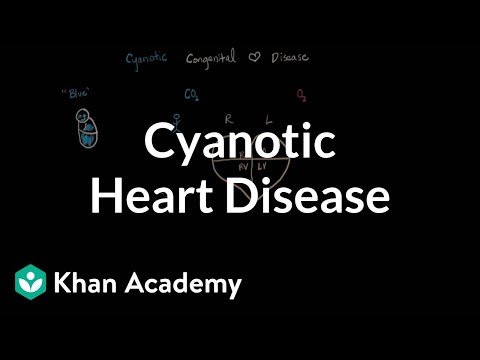 Video: Što je cijanotična bolest srca?
