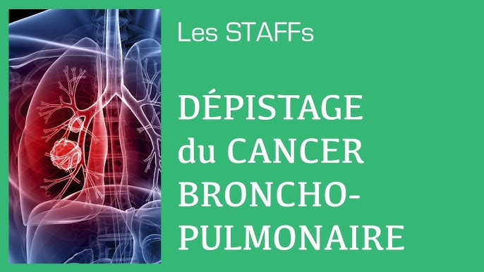 L'hôpital Saint-Joseph de Marseille lance un programme de dépistage du  cancer du poumon - France Bleu