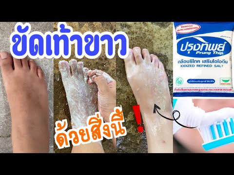 ขัดเท้าขาว เท้าไหม้แดดแก้ได้ด้วยส่วนผสมใกล้ตัว