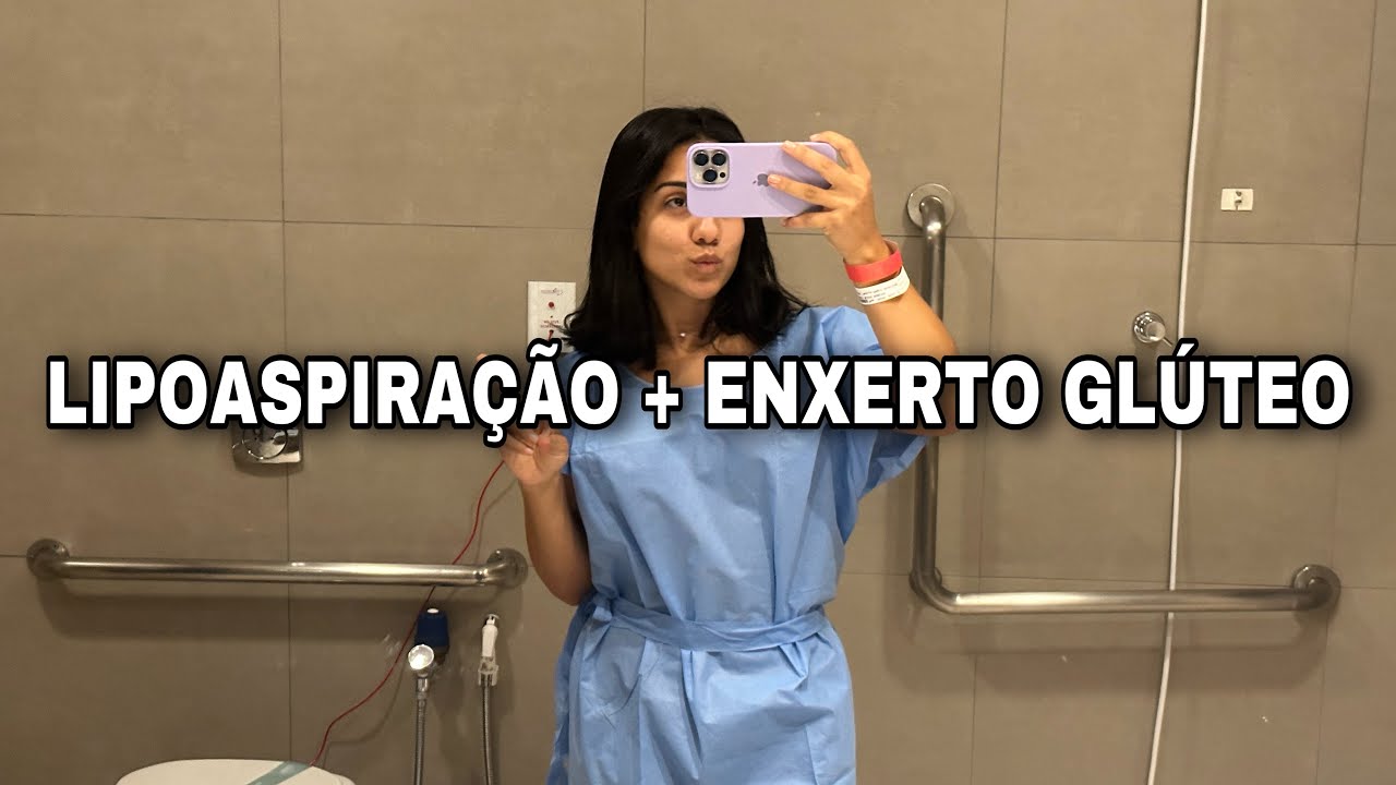 Lipoenxertia: Antes E Depois _ Lipoenxertia no glúteo antes e depois ...