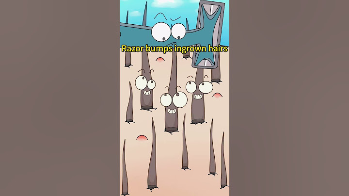 Girls, please don’t use tweezers to remove hair in summer#laserhair # #hair #hairremoval #satisfying