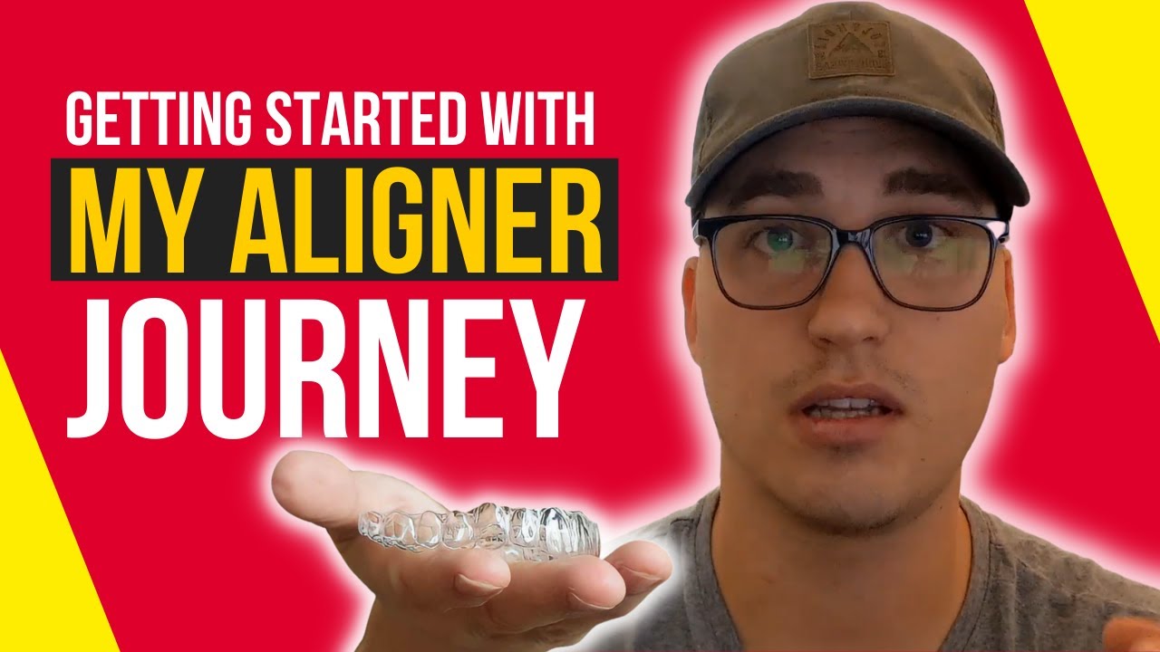 NewSmile Clear Aligners Review How to get started? Is it worth it