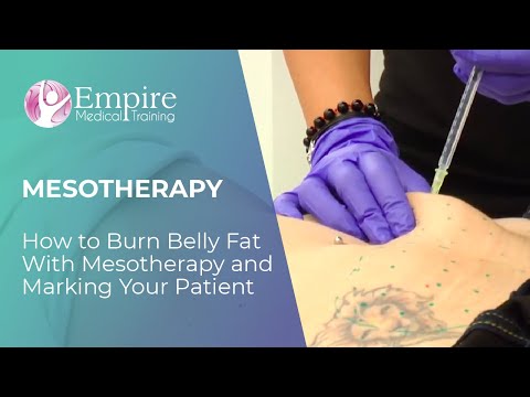 How to Burn Belly Fat With Mesotherapy and Marking Your Patient
