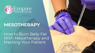 How to Burn Belly Fat With Mesotherapy and Marking Your Patient