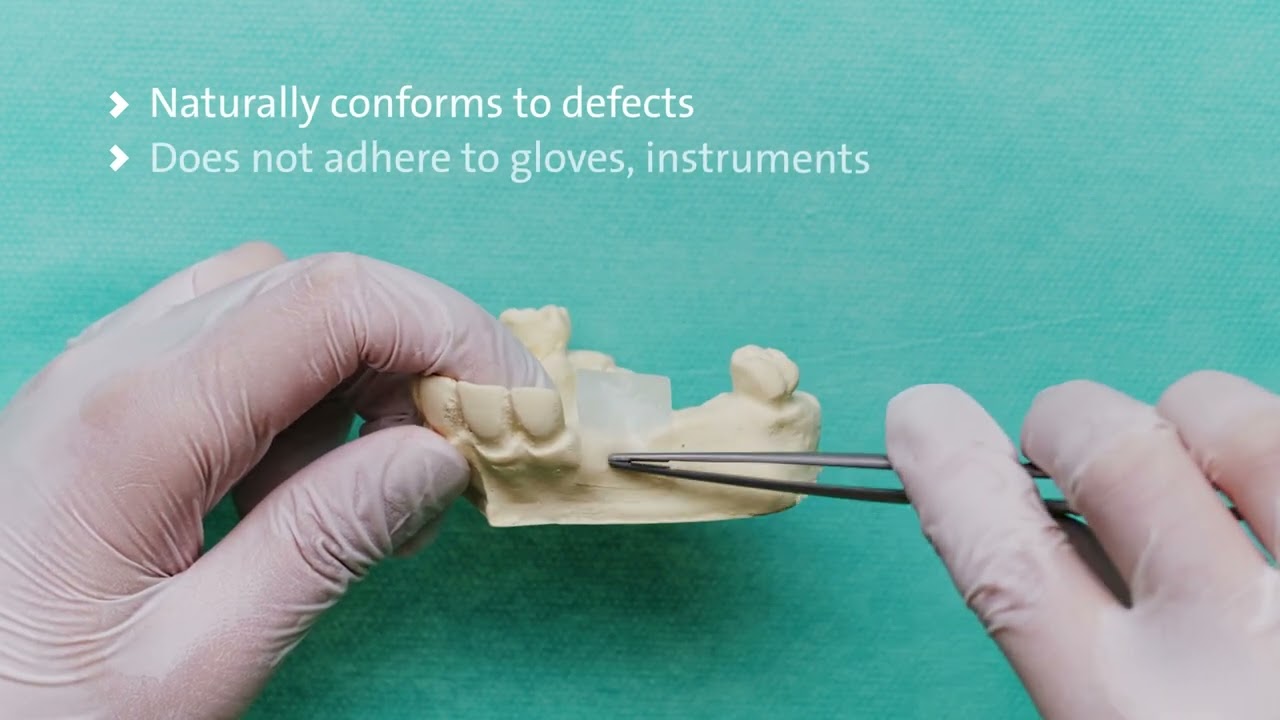 Straumann® Membrane Flex Handling Video - Straumann® Biomaterials
