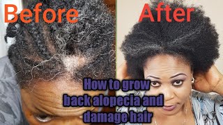 How to grow back alopecia damaged hair