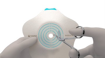 Instructie SenSura® Mio Convex Flip 2 delig