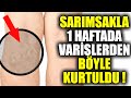 Sarımsak İle Varislerden Anından Kurtulun