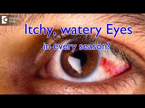 Video: Betekenen jeukende ogen?