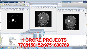 MRI Brain Fusion Based Image Segmentation And Detection Using KNN Classification With Double Images