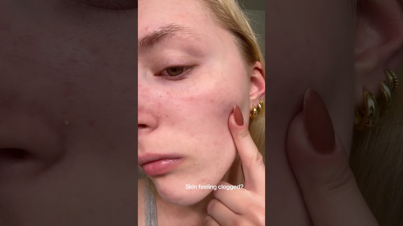 This NEEDLY glow peeling serum has been saving me recently during this humidity🥵 