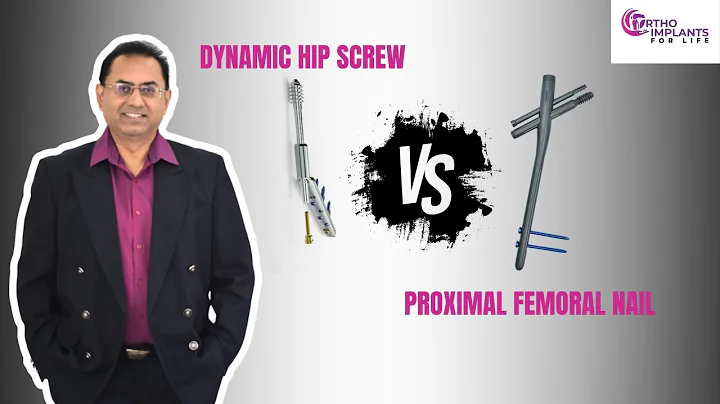 DHS vs PFN - Which Fixation Method is Better for Hip Fractures?