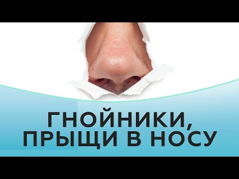 Гнойники, прыщи в носу