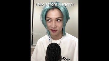 Felix before surgery🖤 #straykids #Felix #shorts #explore