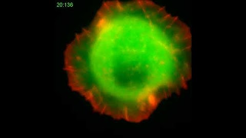 Formin mDia1 is important during early cell spreading