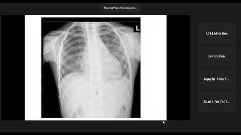 TT CĐHA | Module Tim Mạch