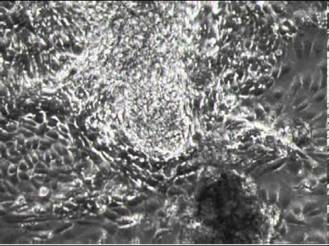 Video: Samtidig Forplantning Og Differentiering Af Humane Embryonale Stamceller Til Kardiomyocytter I En Defineret Mikrobærer-spinnerkultur
