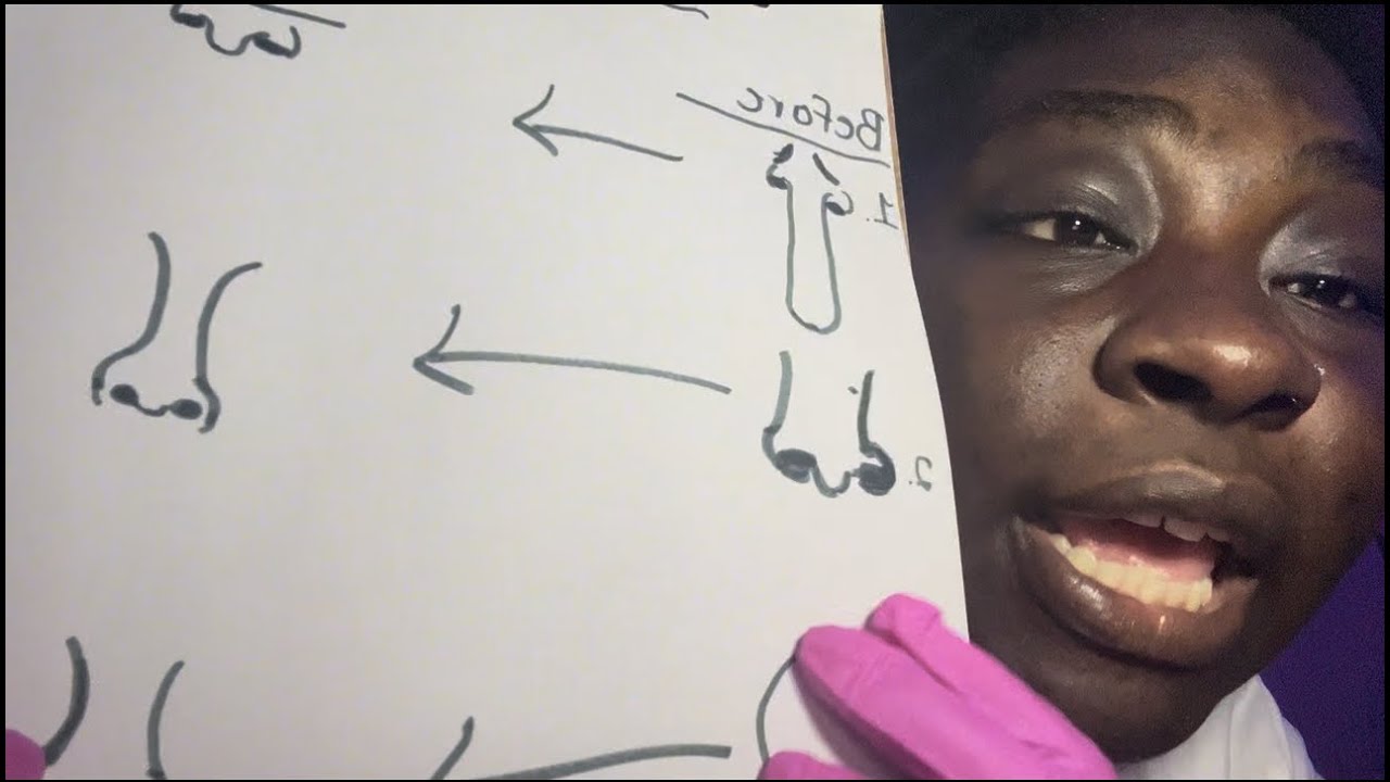 ASMR: nose job consultation 👃🏾💉 | vlogmas day: 9