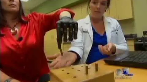 Revolutionary Bionic Hand Gives Texas Woman a Worl...