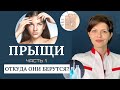 Проблемная кожа | ТОП 5 причин появления прыщей на лице | Профилактика прыщей