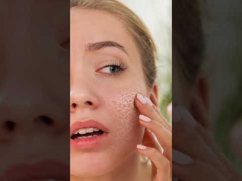 Video: Er aquaphor god til overeksfolieret hud?