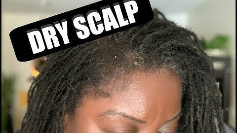 My Dry Scalp Issues