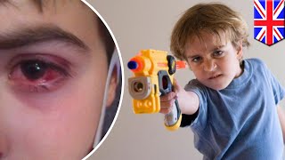 Nerf guns: Toy can cause eye swelling, bleeding when hit with foam bullets - TomoNews screenshot 2