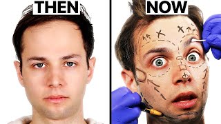 Should The Try Guys Do Plastic Surgery? | Surgeon Reacts