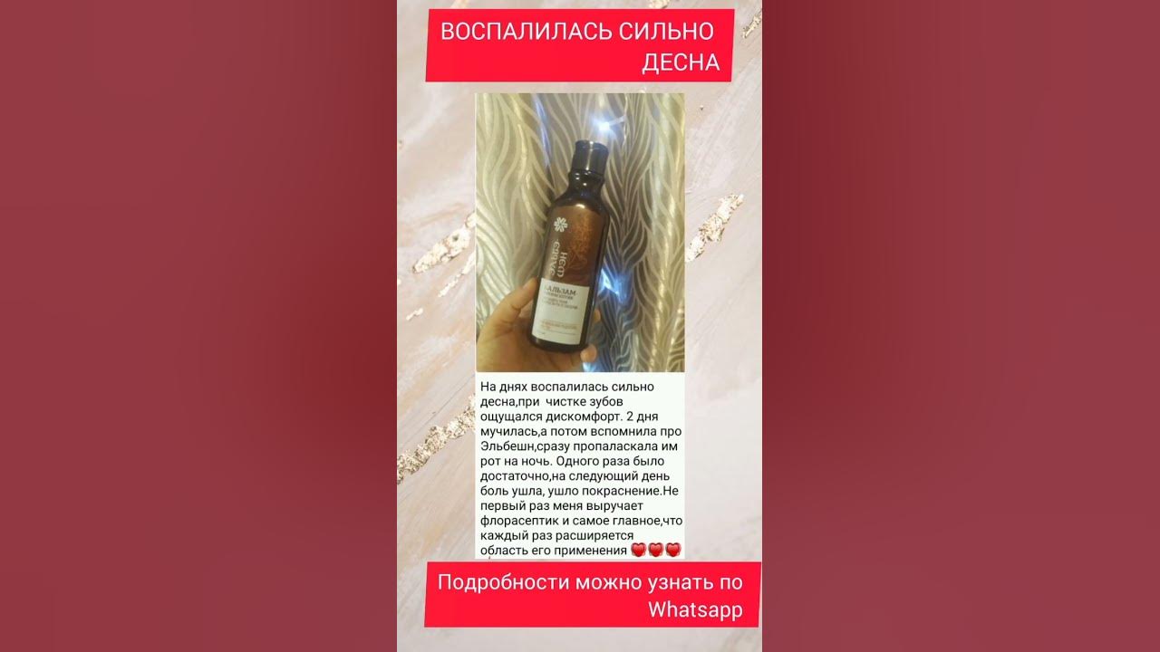 СИЛЬНО ВОСПАЛИЛАСЬ ДЕСНА. ПОДРОБНЕЕ РАССКАЗЫВАЮ В WhatsApp +79276559060 ...
