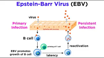 Cosa causa Epstein Barr?