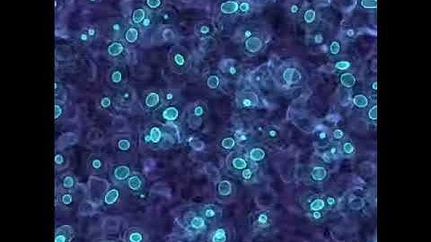 Volume rendering of solitons in self-interacting scalar field