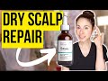 Get rid of your dry scalp for good with these dermatologist tips