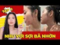 TRỊ SẠCH SỢI BÃ NHỜN [ tập 2 ] Nhu đúng thời điểm với sợi bã nhờn