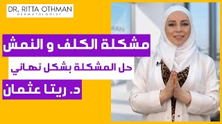 التخلص من الكلف والنمش | بشرة صافية